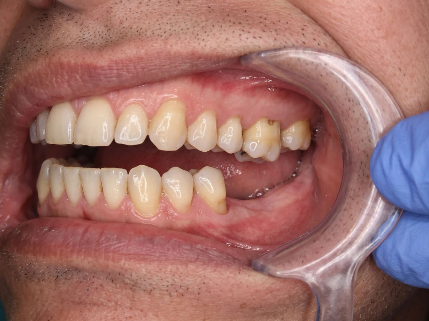Case 009, Before