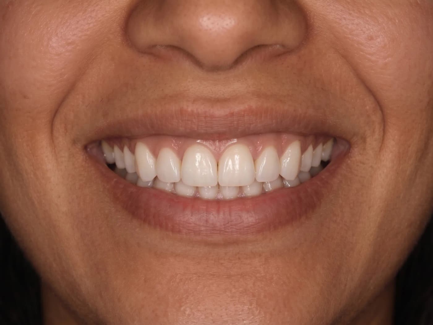 Case 014 after treatment