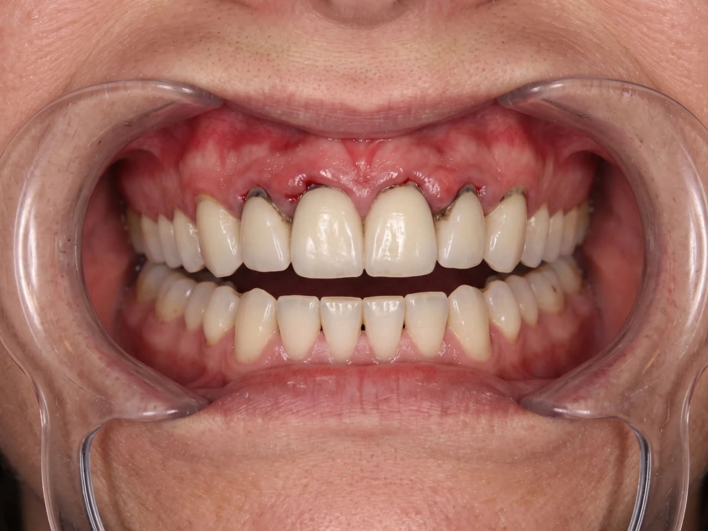 Case 021, Before