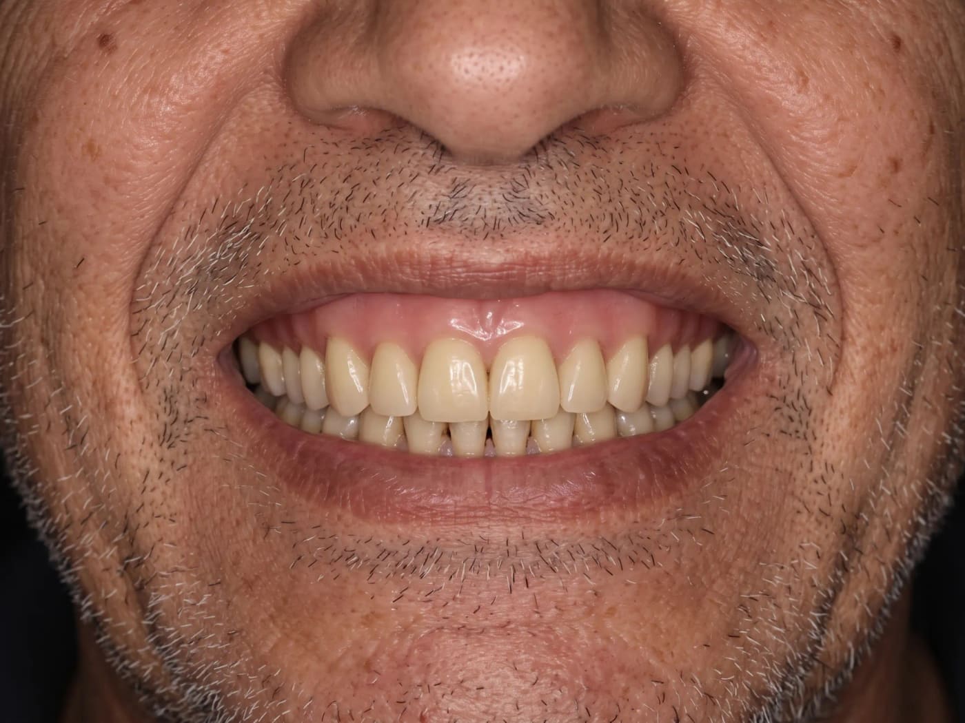Case 026, Before