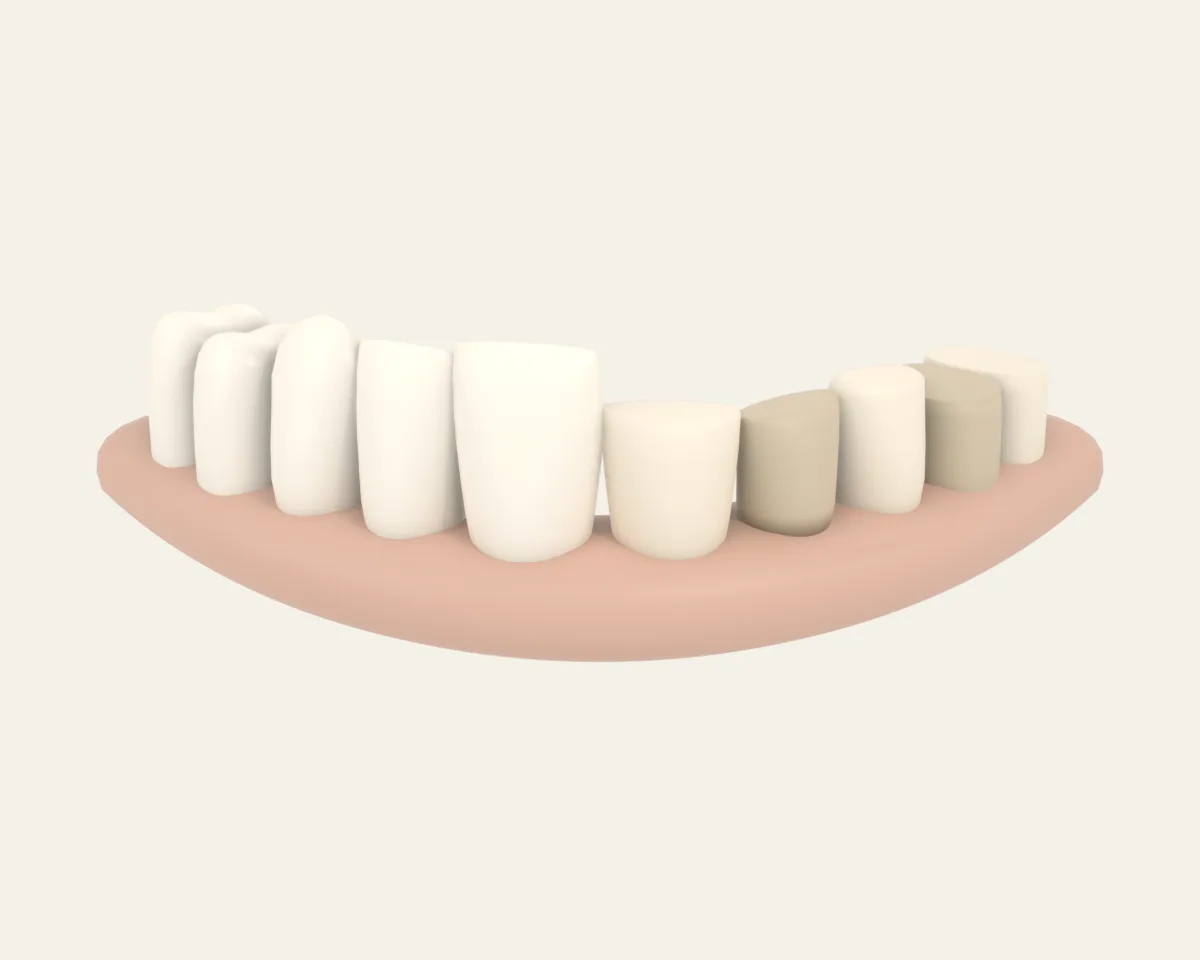 Illustration poster for Full mouth restoration